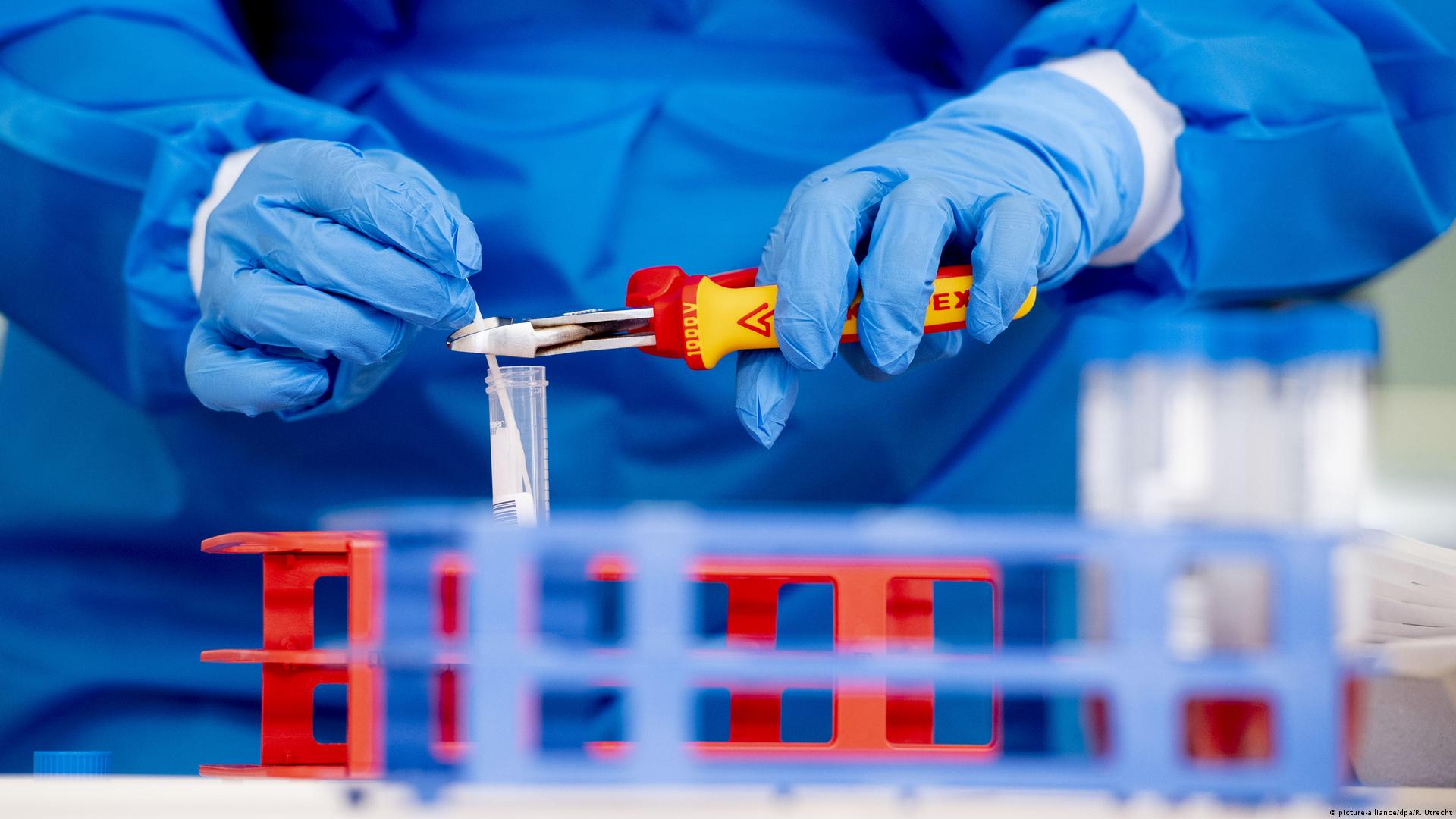 ПЛР дослідження